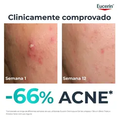 SERUM EUCERIN DERMOPURE OIL CONTROL 40ML