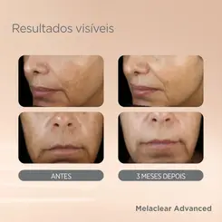 ISDIN SERUM FACIAL CLAREADOR MELACLEAR ADVANCED 30ML