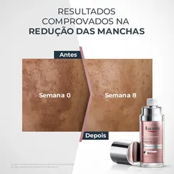 SERUM EUCERIN CLAREADOR ANTI PIGMENT DUAL 30ML